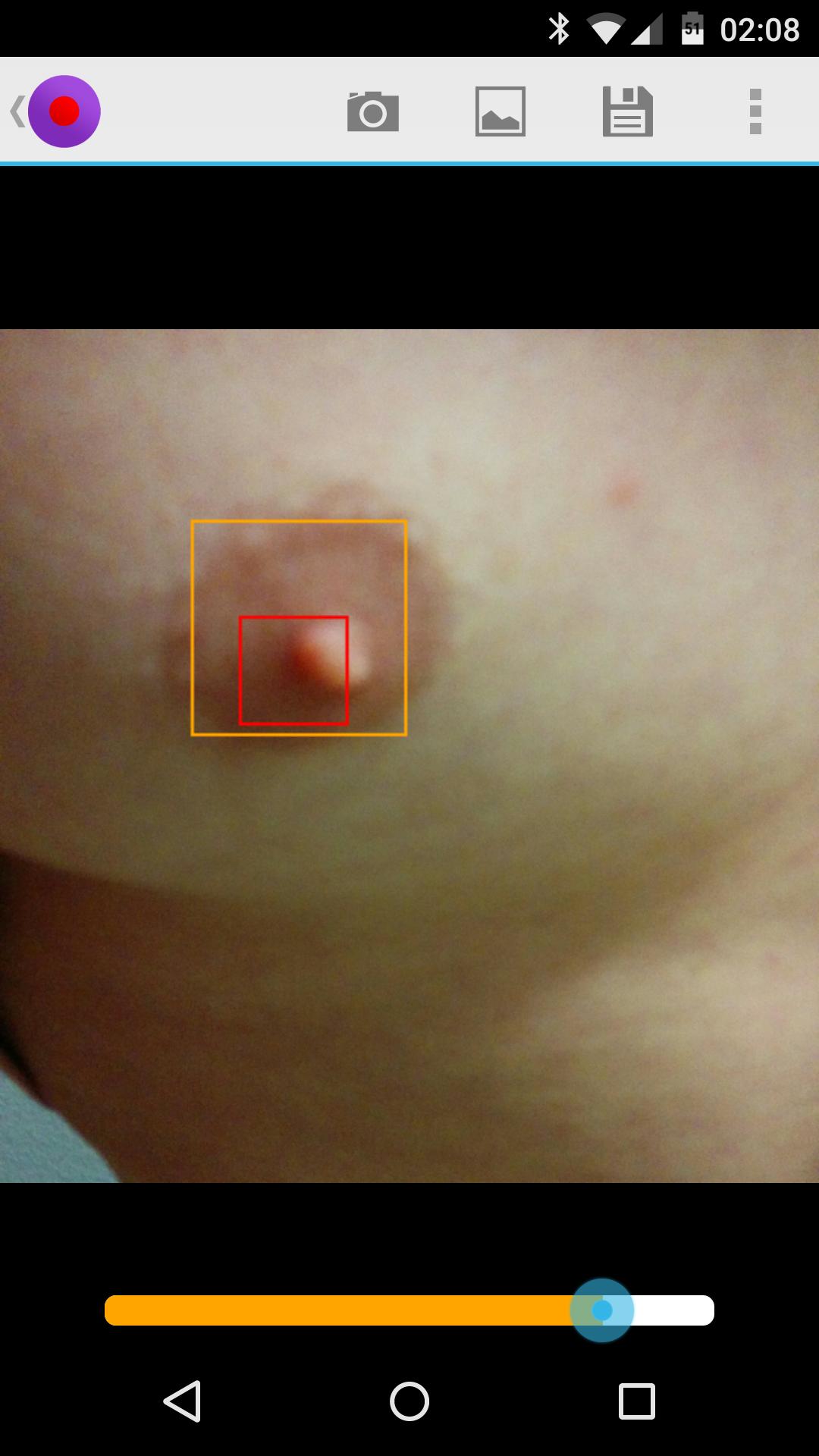 Nippler