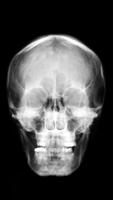 X-ray Body Scanner Prank