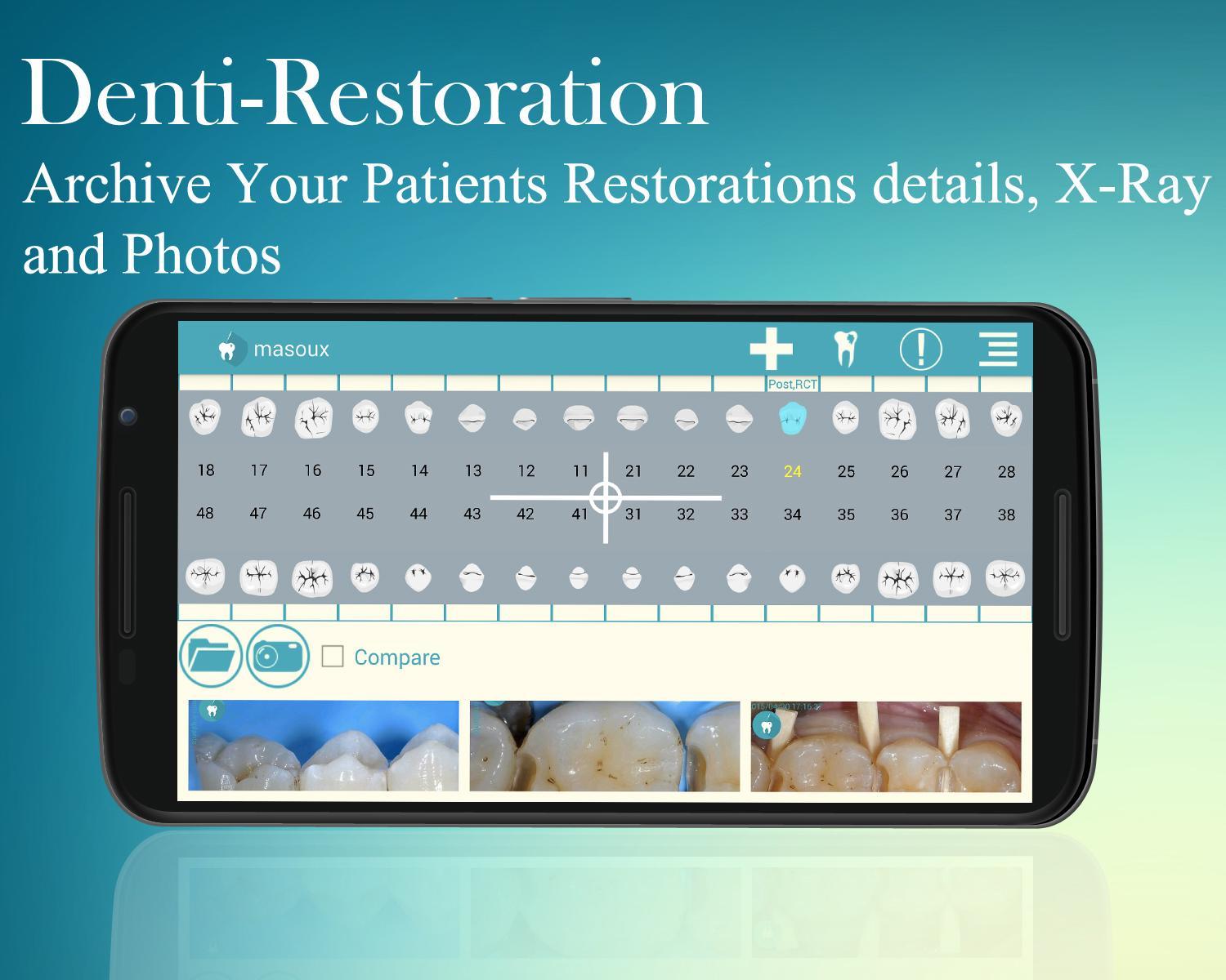 Denti-Restoration