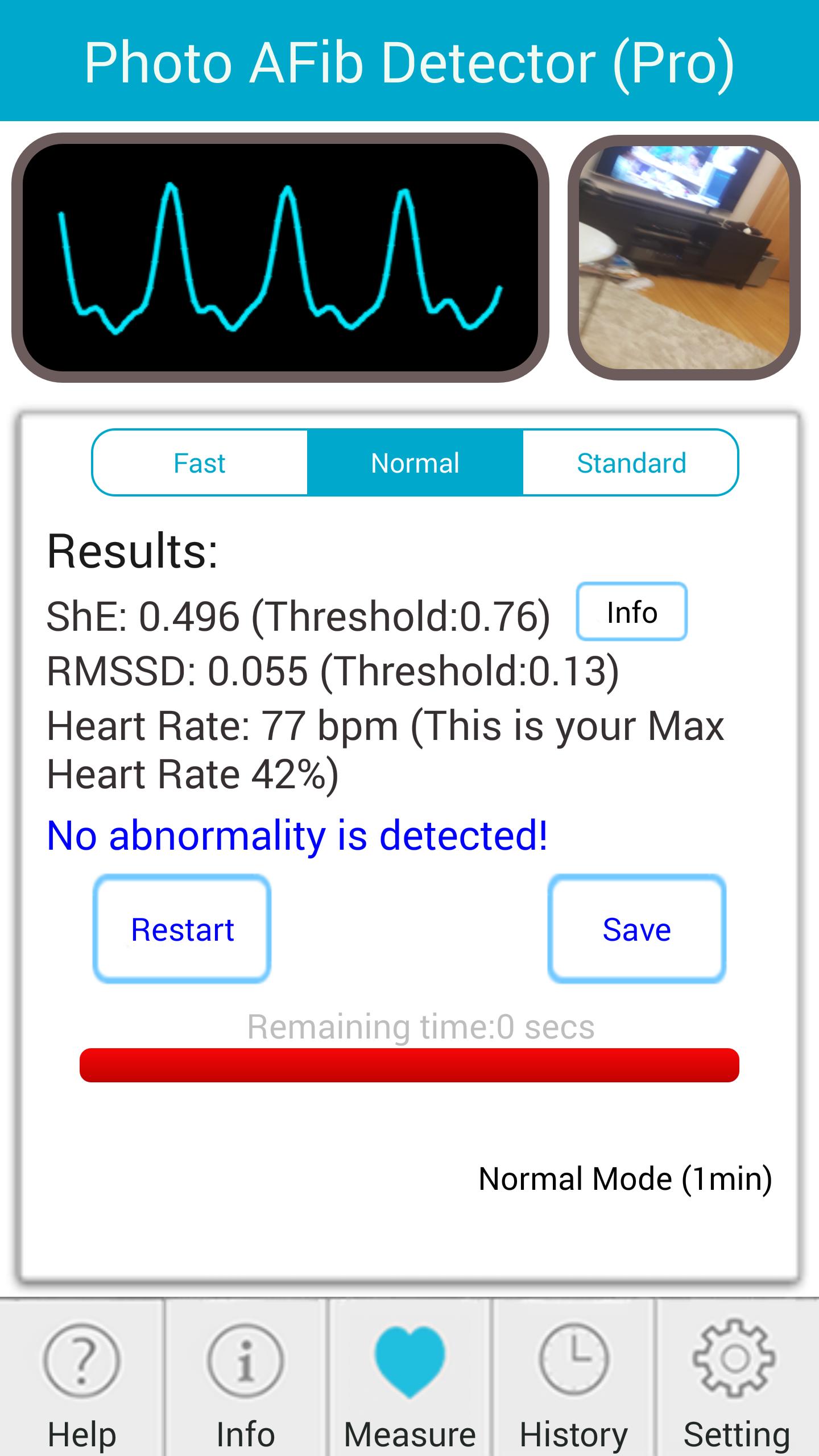 Photo AFib Detector
