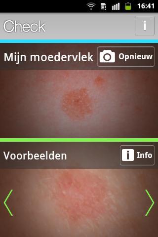 Huidmonitor