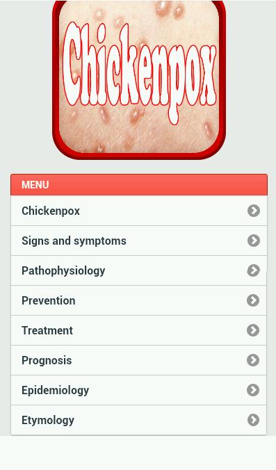 Chickenpox Disease