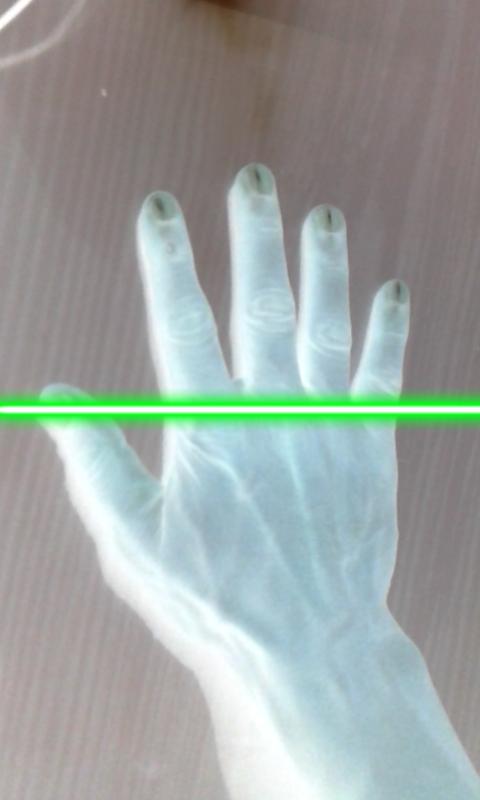 Candy X-Ray :Prank