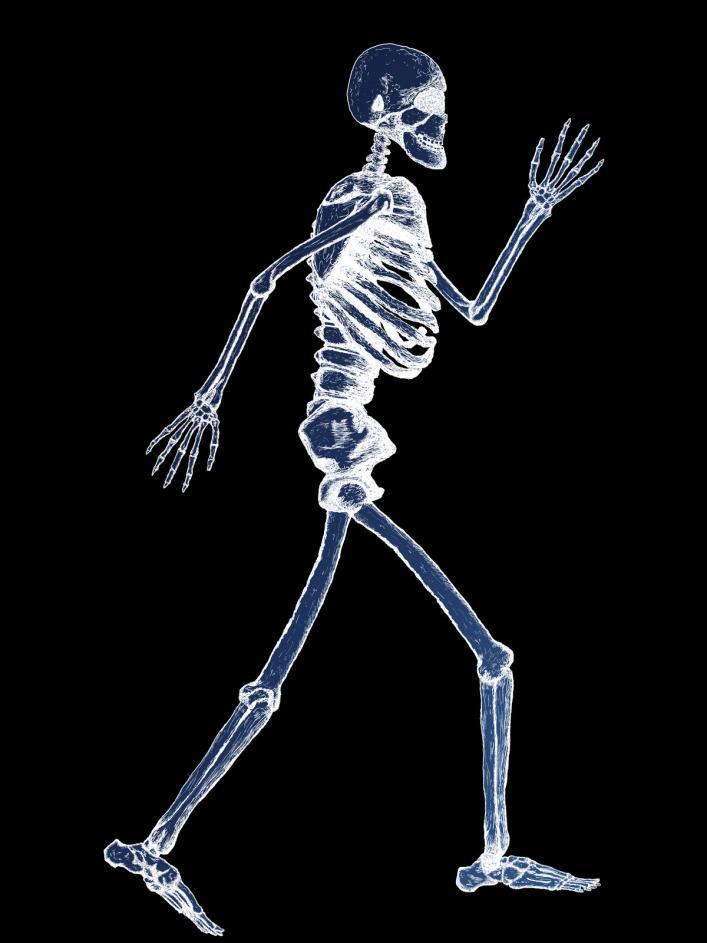 The X-Ray Scanner Prank