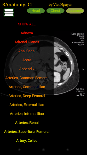 Radiology CT Anatomy
