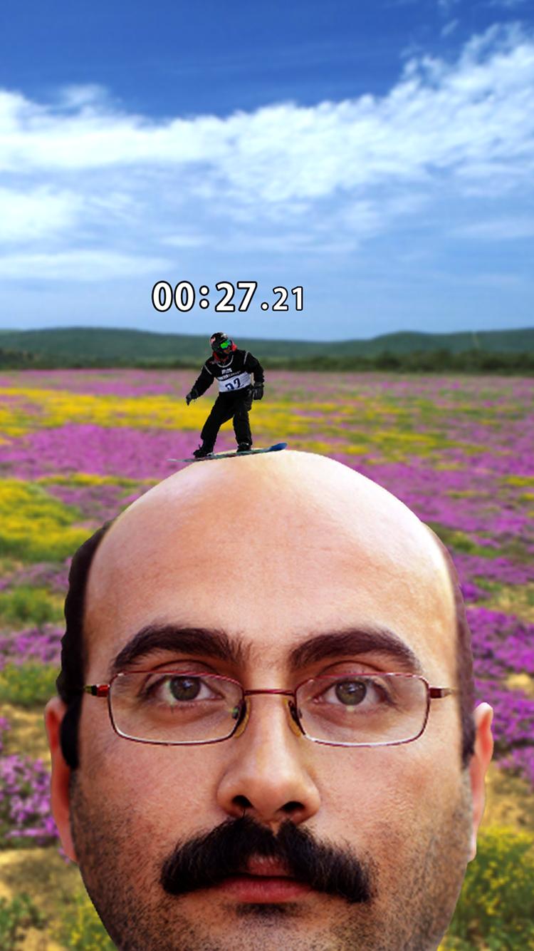 Bald Game