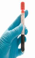 Blood Test Explained