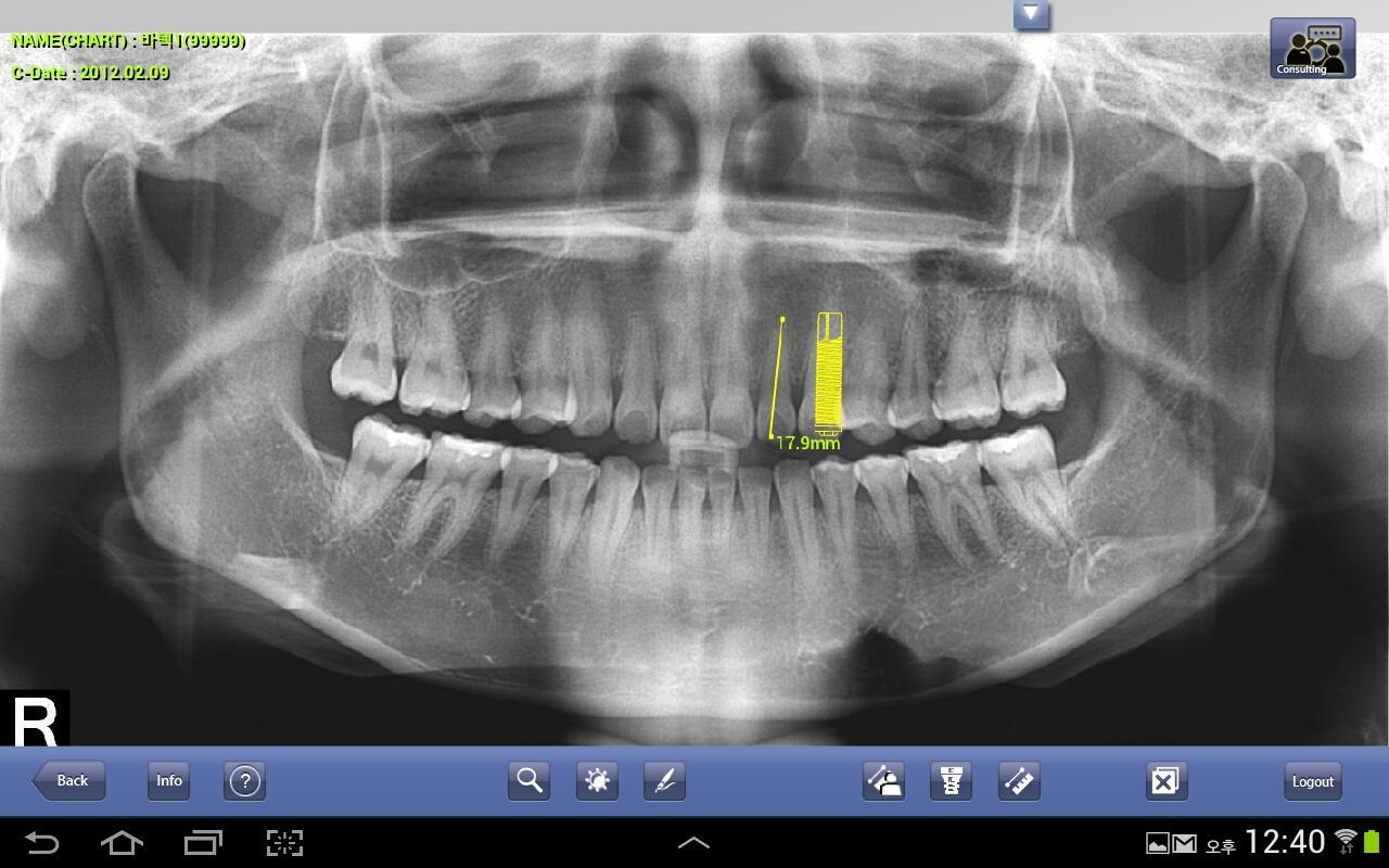 EasyDent M Ver2.0