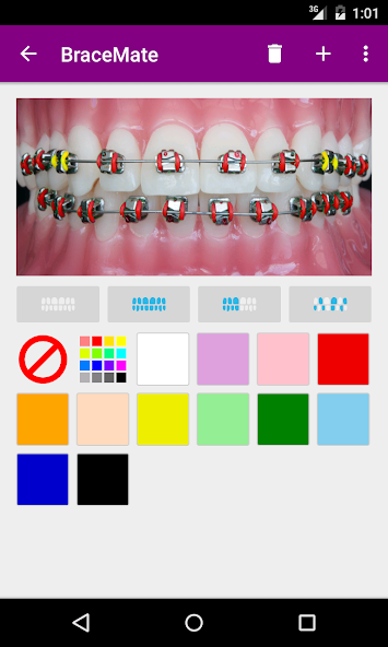 BraceMate