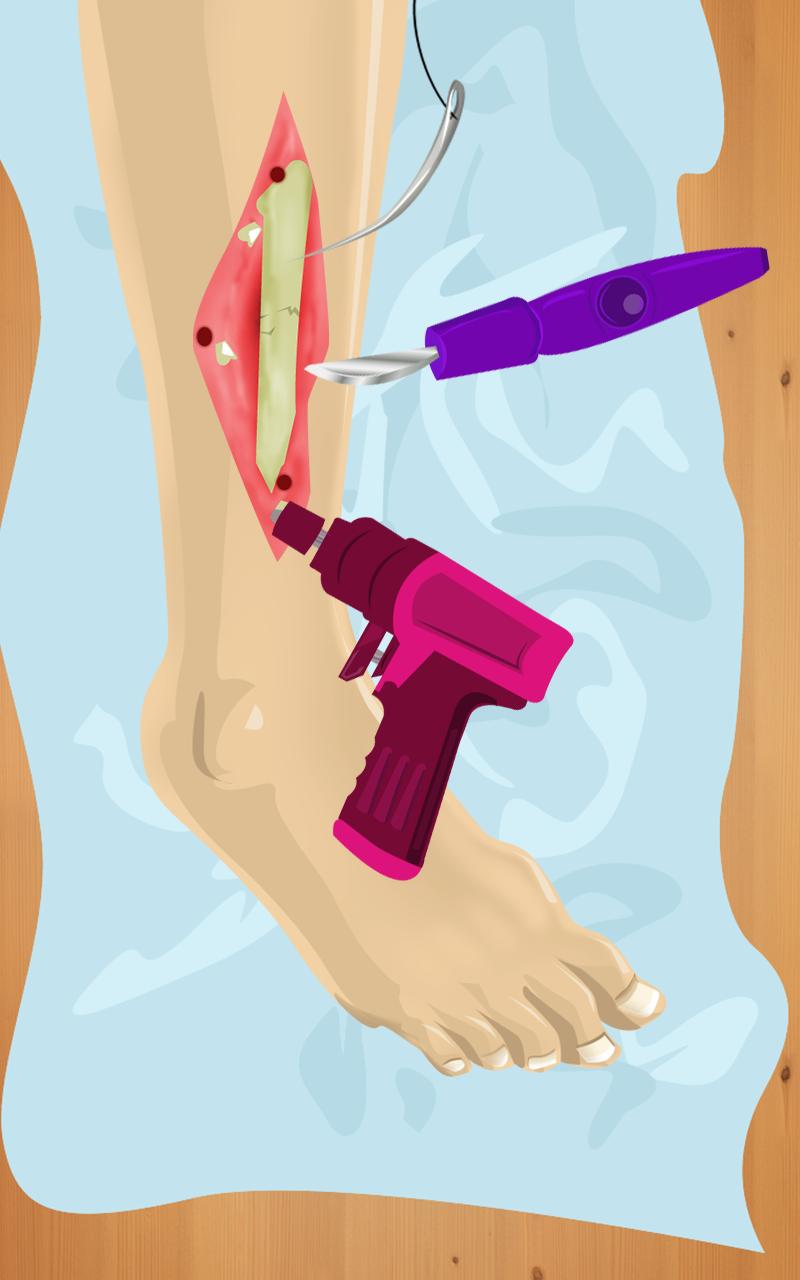 Leg Operation