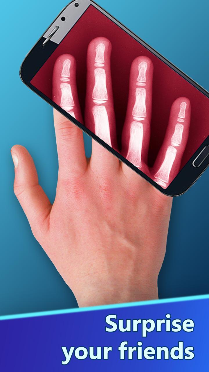 The X-Ray Scanner